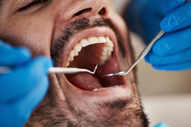 Best Dentist for Dental Trauma  in Wentworth, NC
